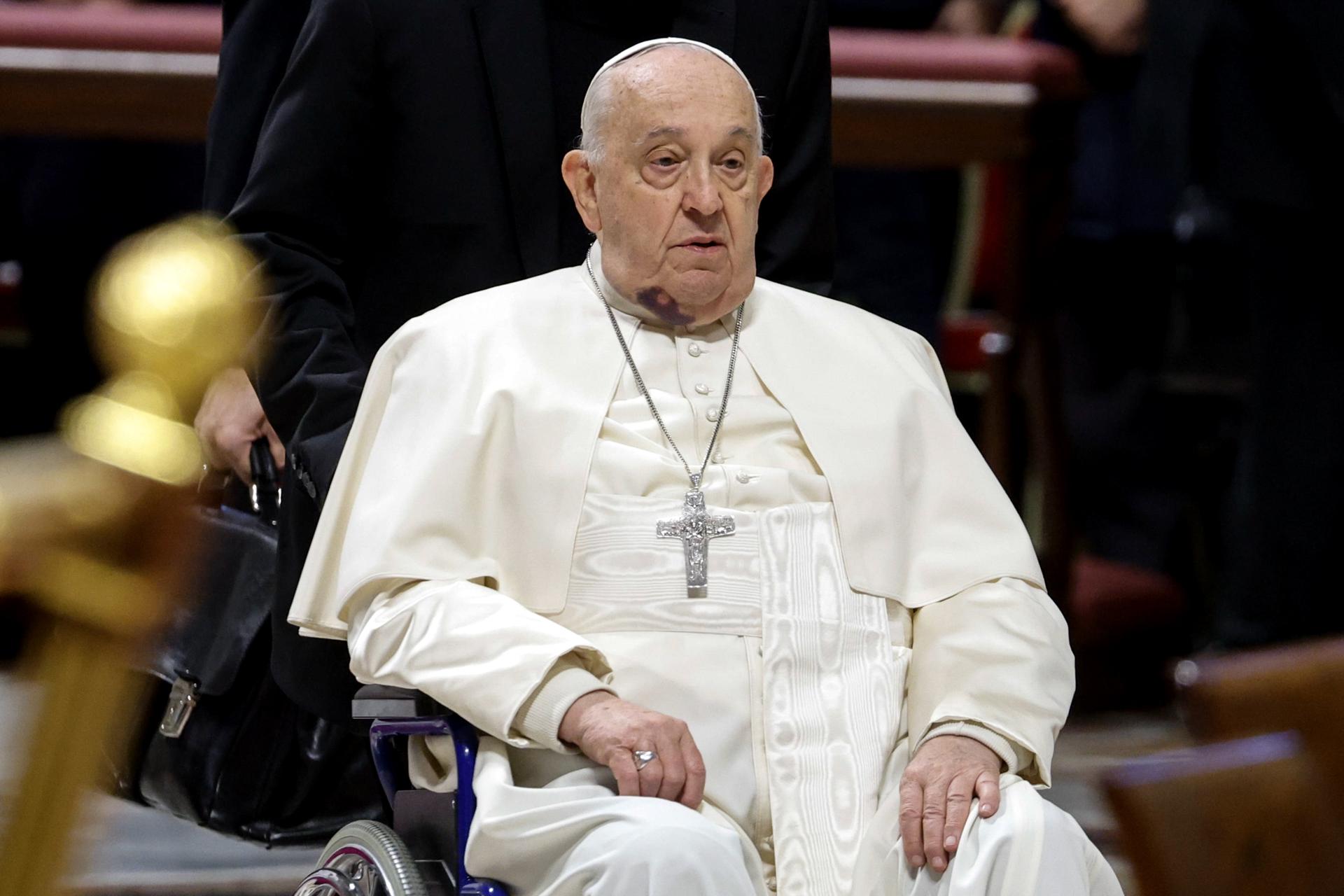 Papa Francisco se hace un hematoma en el rostro tras golpearse con una mesa